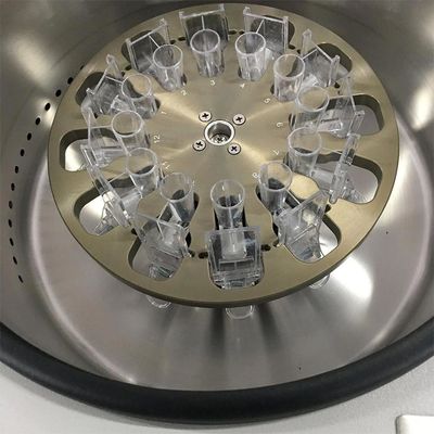 TXD3 Centrifuge met lage snelheid met 12 schuifcapaciteit 1 jaar garantie en geluid ≤ 60 dB ((A) voor bronchopunktuurvloeistof