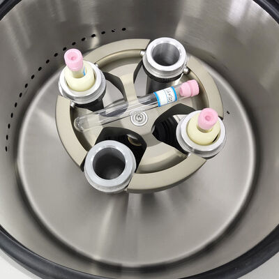PRP-centrifuge-machine met maximale snelheid 5000 t/min 3555xg RCF en LCD-display voor laboratoriumgebruik